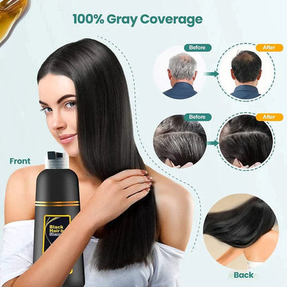 BUY 1,GET 2 FREE!!! @399🔥Flat 65% OFF Today Only 🔥3-IN-1 BLACK HAIR DYE SHAMPOO (AYURVEDIC NO SIDE EFFECT)