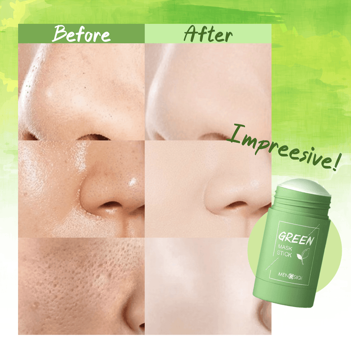 Clayglo™ Green Tea Pore Control Stick Mask - Deep Cleansing Pores, Acne Blackhead Remover and Oil Control